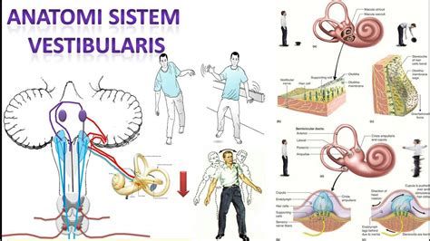 Gangguan pada Sistem Vestibular